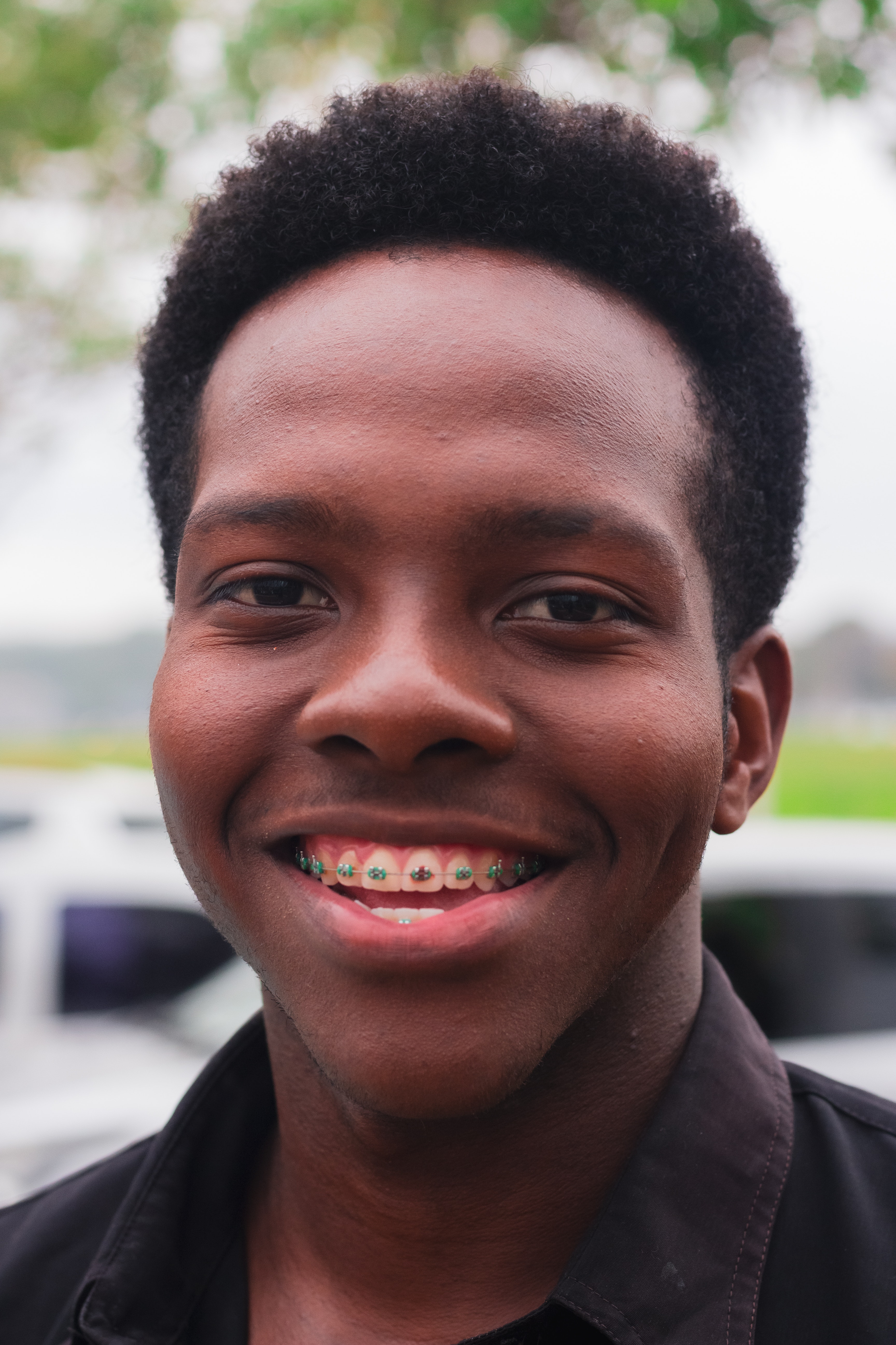 My Braces Are Giving Me The Smile I've Always Wanted