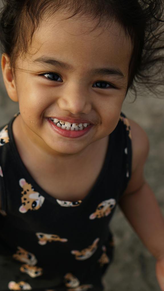 Saying Cheese Shows Off The Spaces Between My Teeth
