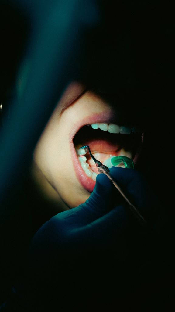 My Dentist Is Checking My Teeth After She Removed My Space Maintainer